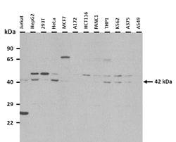 Aviva Systems Biology Corp SSTR4 Antibody - middle region (ARP33359_P050)