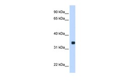 Aviva Systems Biology Corp MLX Antibody - C-terminal region (ARP33424_P050)