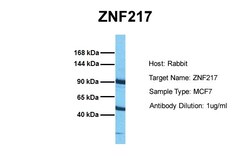Aviva Systems Biology Corp ZNF217 Antibody - middle region (ARP33555_P050)