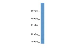 Aviva Systems Biology Corp BTG2 Antibody - middle region (ARP33561_P050)