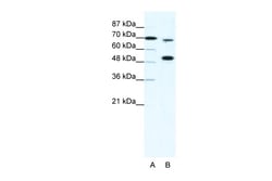 Aviva Systems Biology Corp MLL4 Antibody - N-terminal region (ARP33704_T100)