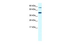 Aviva Systems Biology Corp EPB42 Antibody - middle region (ARP33799_P050)