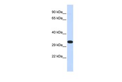 Aviva Systems Biology Corp KIF25 Antibody - N-terminal region (ARP33972_P050)