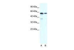 Aviva Systems Biology Corp G22P1 Antibody - N-terminal region (ARP34117_T100)