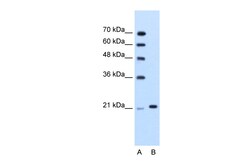 Aviva Systems Biology Corp TRIM26 Antibody - N-terminal region (ARP34178_T100)