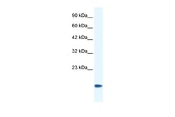 Aviva Systems Biology Corp CSRP3 Antibody - middle region (ARP34181_P050)