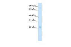 Aviva Systems Biology Corp CSRP3 Antibody - middle region (ARP34181_T100)