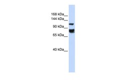 Aviva Systems Biology Corp HDAC4 Antibody - middle region (ARP34230_P050)