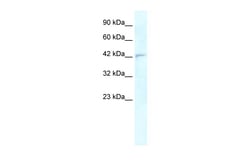 Aviva Systems Biology Corp RNF2 Antibody - middle region (ARP34289_P050)