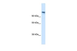Aviva Systems Biology Corp TIP120A Antibody - N-terminal region (ARP34585_T100)