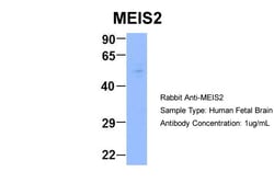 Aviva Systems Biology Corp MEIS2 Antibody - middle region (ARP34683_P050)