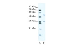 Aviva Systems Biology Corp BTBD3 Antibody - middle region (ARP34740_T100)