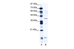 Aviva Systems Biology Corp CREM Antibody - N-terminal region (ARP34777_T100)