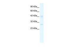 Aviva Systems Biology Corp BRD9 Antibody - N-terminal region (ARP34832_T100)