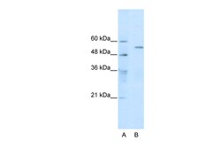 Aviva Systems Biology Corp TRIM35 Antibody - C-terminal region (ARP34872_P050)
