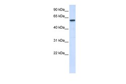 Aviva Systems Biology Corp TRIM41 Antibody - middle region (ARP34893_P050)