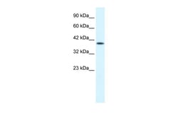Aviva Systems Biology Corp P2RX2 Antibody - middle region (ARP35259_T100)
