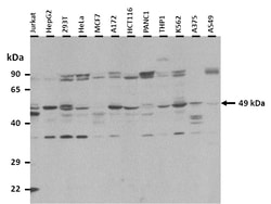 Aviva Systems Biology Corp KCNJ12 Antibody - middle region (ARP35315_P050)