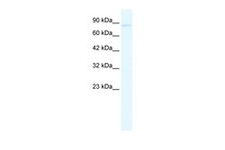 Aviva Systems Biology Corp GRIK2 Antibody - N-terminal region (ARP35340_T100)