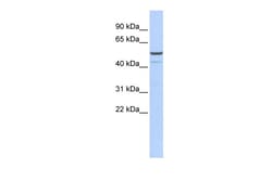 Aviva Systems Biology Corp KCNK12 Antibody - middle region (ARP35349_P050)