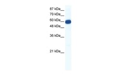 Aviva Systems Biology Corp SLC18A1 Antibody - N-terminal region (ARP35650_P050)