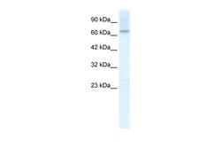 Aviva Systems Biology Corp PIAS2 Antibody - C-terminal region (ARP35734_T100)