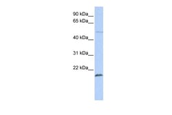 Aviva Systems Biology Corp ZNF79 Antibody - N-terminal region (ARP35824_P050)