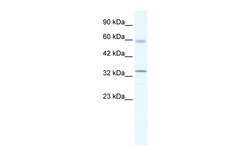 Aviva Systems Biology Corp ZBTB7A Antibody - middle region (ARP35899_T100)