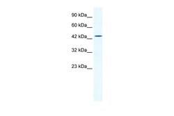 Aviva Systems Biology Corp DMRTB1 Antibody - middle region (ARP36093_T100)