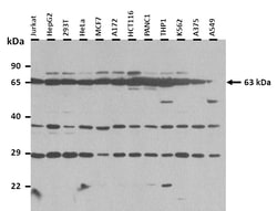 Aviva Systems Biology Corp ZFP91 Antibody - N-terminal region (ARP36119_P050)