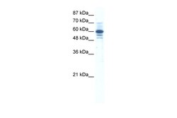 Aviva Systems Biology Corp ZNF276 Antibody - middle region (ARP36164_P050)