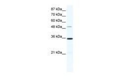 Aviva Systems Biology Corp ZNF610 Antibody - N-terminal region (ARP36230_P050)