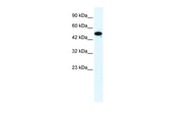 Aviva Systems Biology Corp FLJ31875 Antibody - middle region (ARP36267_T100)