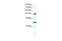 Aviva Systems Biology Corp BAT1 Antibody - C-terminal region (ARP36372_P050)