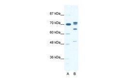 Aviva Systems Biology Corp DDX21 Antibody - N-terminal region (ARP36374_P050)
