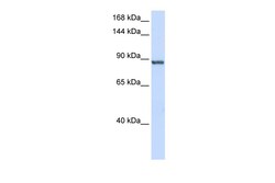 Aviva Systems Biology Corp INTS6 Antibody - C-terminal region (ARP36404_P050)