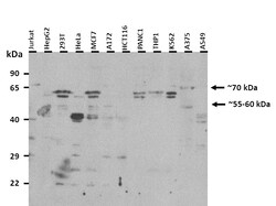 Aviva Systems Biology Corp DDX41 Antibody - C-terminal region (ARP36438_T100)