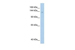 Aviva Systems Biology Corp MOV10 Antibody - C-terminal region (ARP36480_T100)