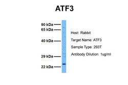 Aviva Systems Biology Corp ATF3 Antibody - middle region (ARP36556_P050)