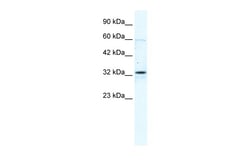Aviva Systems Biology Corp GJB1 Antibody - C-terminal region (ARP36600_T100)