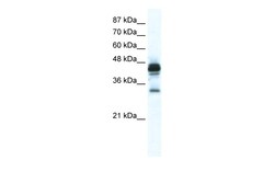 Aviva Systems Biology Corp GJE1 Antibody - C-terminal region (ARP36638_T100)