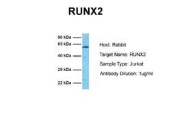 Aviva Systems Biology Corp RUNX2 Antibody - middle region (ARP36678_T100)