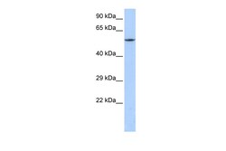 Aviva Systems Biology Corp CACNB1 Antibody - C-terminal region (ARP36744_P050)