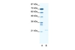 Aviva Systems Biology Corp TRPM3 Antibody - N-terminal region (ARP36776_P050)