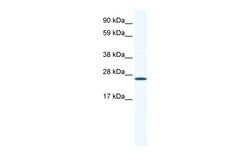 Aviva Systems Biology Corp ARNTL Antibody - N-terminal region (ARP36822_T100)