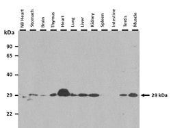 Aviva Systems Biology Corp Tfam Antibody - C-terminal region (ARP36993_P050)