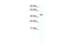 Aviva Systems Biology Corp FOXF1A Antibody - C-terminal region (ARP37047_T100)