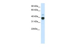Aviva Systems Biology Corp HOXA11 Antibody - C-terminal region (ARP37064_P050)