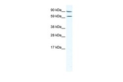 Aviva Systems Biology Corp MTA2 Antibody - middle region (ARP37166_T100)