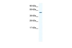 Aviva Systems Biology Corp SP1 Antibody - middle region (ARP37192_T100)
